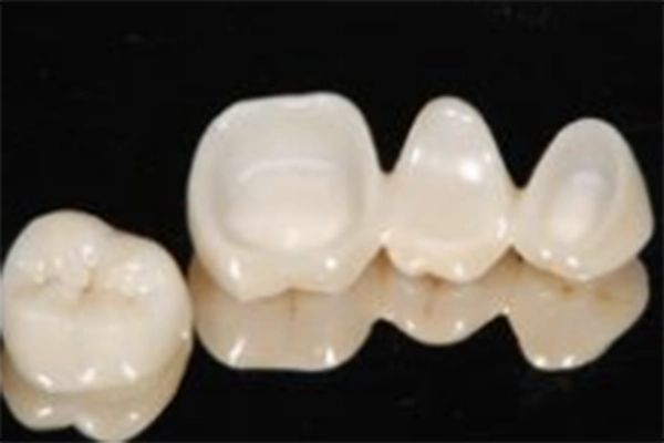 ジルコニアセラミック