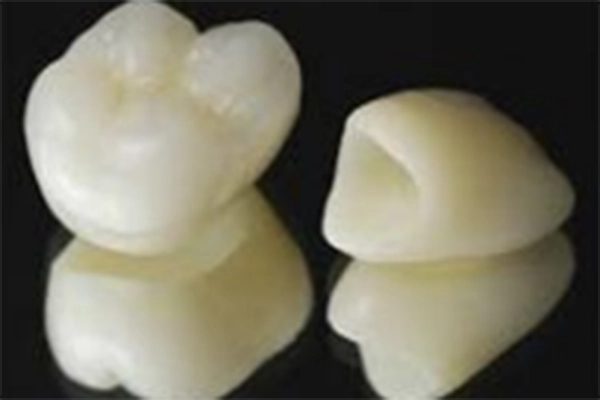 オールセラミック