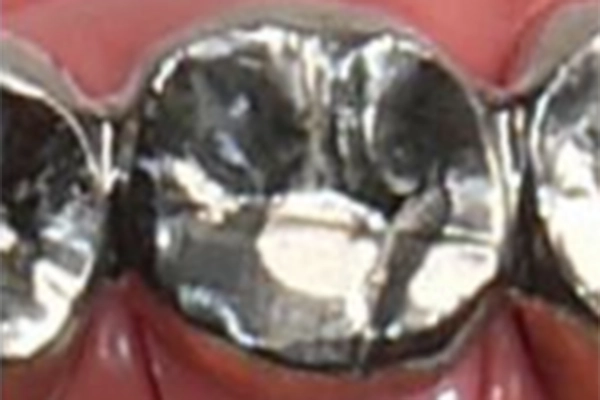 金銀パラジウム合金