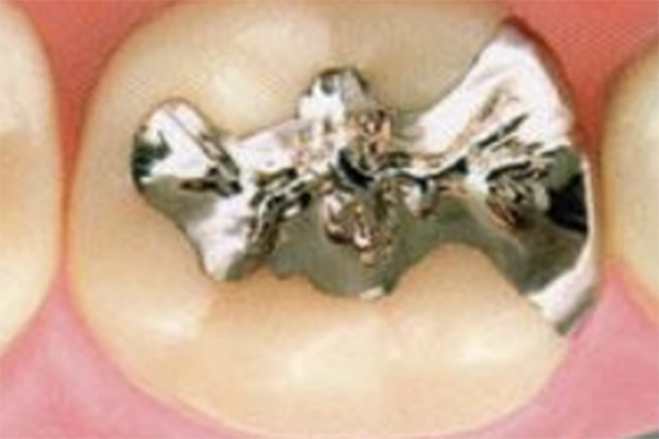 金銀パラジウム合金