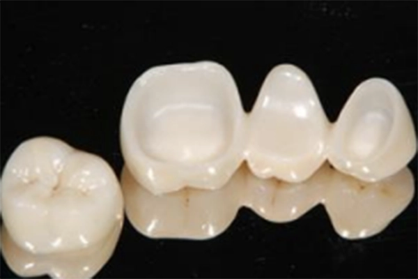 ジルコニアセラミック