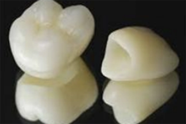 オールセラミック