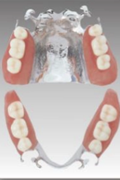 コバルトクロム義歯