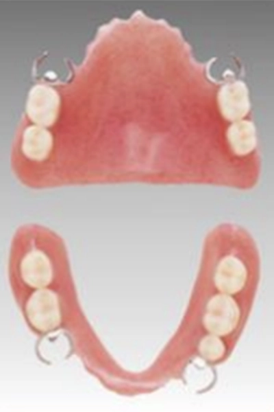 プラスチック義歯