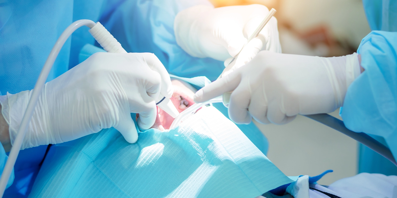 OAMインプラント治療