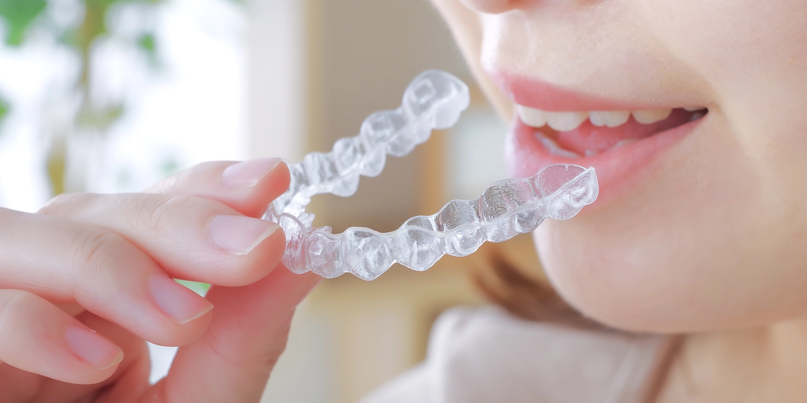 マウスピース矯正(インビザライン)